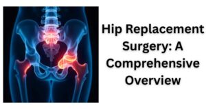 hip replacement surgery